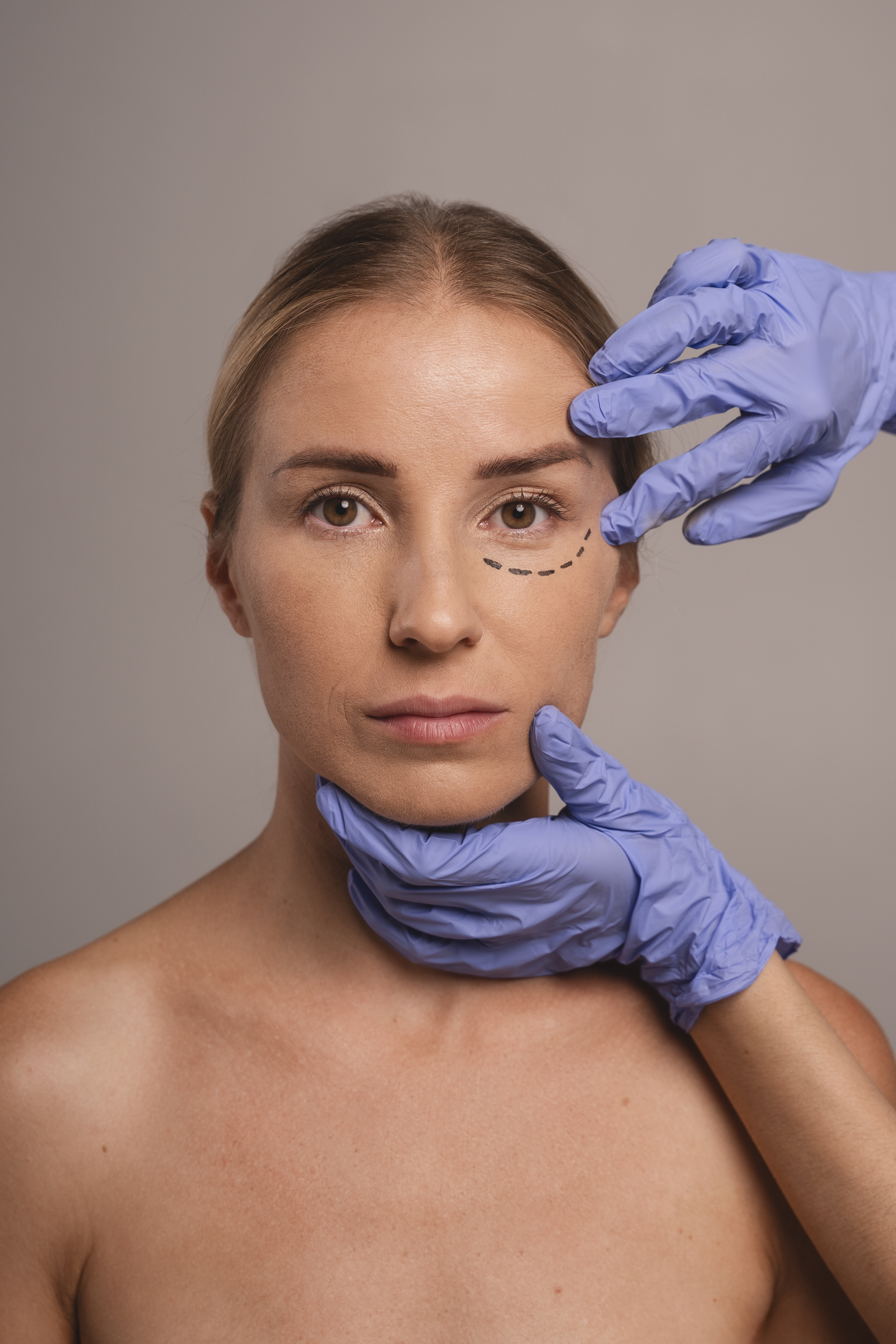 Eyelid cyst removal surgery at The Eye Doctor, Huddersfield